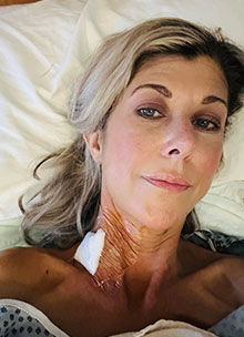 April following successful transplant surgery photo